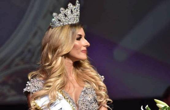 Мис България показа новия нос (СНИМКИ)