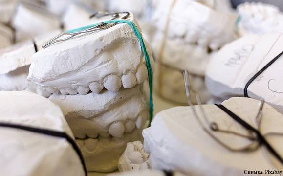 Здравната каса ще подпомага финансово пациенти за изработка на зъбни протези