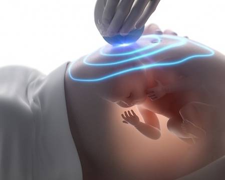 Опасно ли е да се прави ултразвуков преглед на бременни?