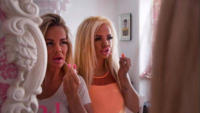 Майка и дъщеря пръснаха над 50 хиляди евро за пластични операции, а резултатът се оказа плачевно страшен! (СНИМКИ)