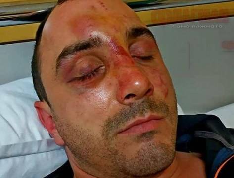 Ужас в Айтос: Циганска орда преби до безобразие Пламен, остави го да лежи в локва кръв насред пътя, а после нахлу в дома на…