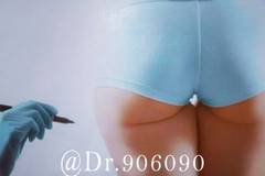 Brazilian Butt Lift (Gluteoplasty or Buttock Augmentation)