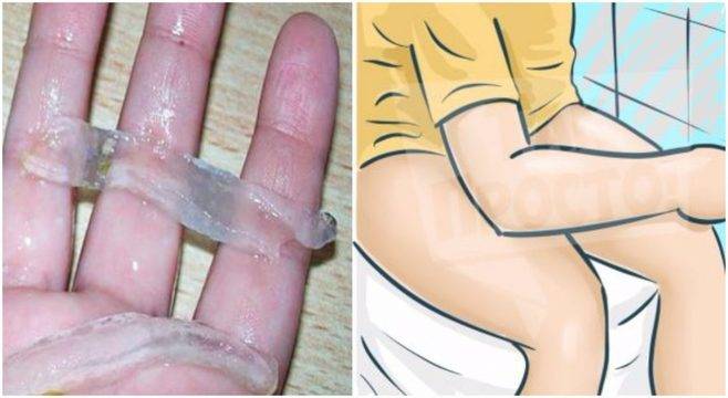 Години се мъчих като грешен дявол, а било толкова просто! Най-ефикасното лечение за хемороиди е под носа ни: