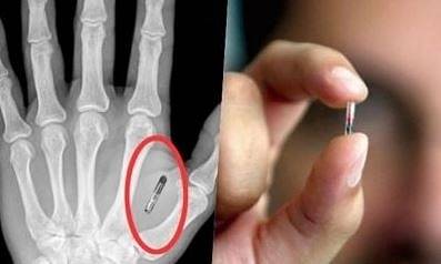 Над 4000 граждани на Швеция вече са имплатирали микрочипове в ръцете си