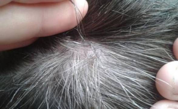 Добре погледнете косата си! Хората, които имат това на главата си НИКОГА няма да се разболеят от рак!