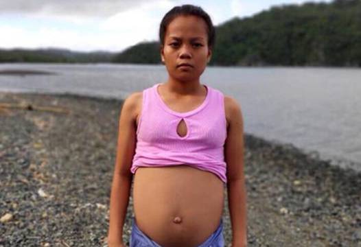 17-годишна ученичка внезапно забременя от риба, на видеозона се видя… (СНИМКИ)