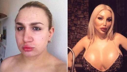 Транссексуалната Ивана легна за над 20 пластични операции, а днес има едни от най-огромните гърди (СНИМКИ 18+)