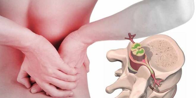 Наш народен лечител разби на пух и прах бялата мафия! Вижте как да се излекувате от дисковата херния за дни!