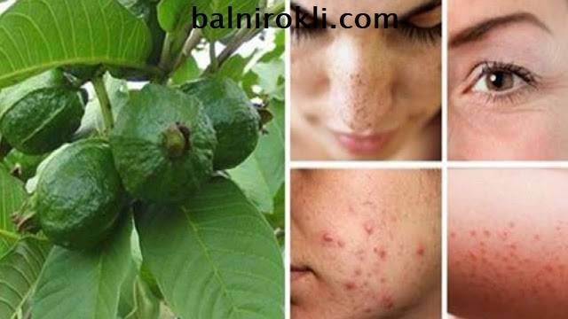 Използвайте Гуава, за да се Освободите от Бръчки, Акне, Тъмни Петна и Кожни Алергии