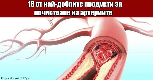 Пълен списък на продуктите, които помагат да се избегне инфаркт
