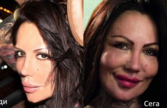 Никита проговори за обезобразяването си, разкри защо не се усмихва