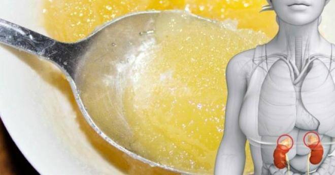 6 причини защо трябва да хапвате по 1 лъжица мед преди лягане