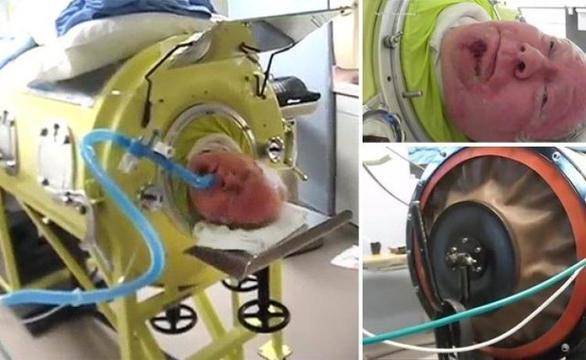 Виж историята на този човек и вече никога няма да си неблагодарен на съдбата си! Видео