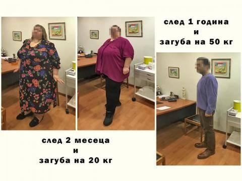 Решението при болестното затлъстяване – Д-р Сотирис Габриел, специалист по бариатрична хирургия