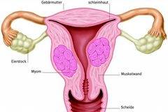 Безплатни прегледи за миома в София
