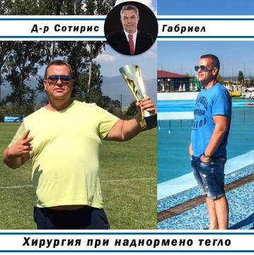 Това е Румен, 2 години след операция за болестно затлъстяване – Д-р Сотирис Габриел, специалист по бариатрична хирургия