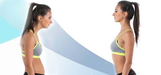 Помгат или вредят ортопедичните колани за корекция на стойката