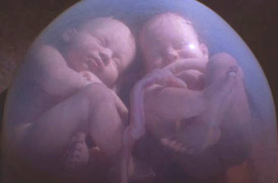 Последни изследвания разкриха нещо много любопитно за близнаците какво правят в коремчето на мама преди раждане