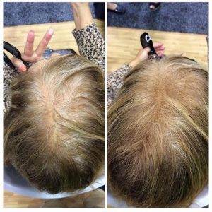 Решение за изтъняла коса