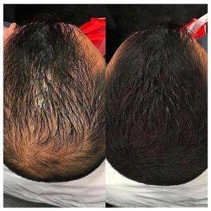 Скрийте изтънената коса