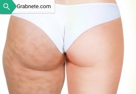 Тайни оръжия за борба с целулита!!!