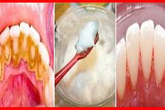 Този Прост Домашен Трик Премахва Зъбния Камък за Минути !