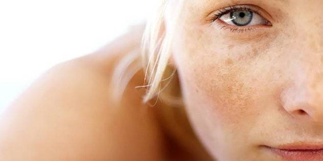 Как да предотвратим появата на пигментни петна върху кожата