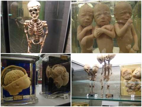 5 от най-необичайните музеи в Амстердам, които трябва да посетите