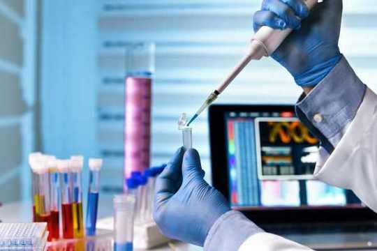 Какво казват за щитовидната жлеза хормоните FT3 и FT4