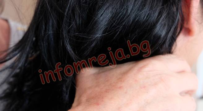 Пореден случай на домашно насилие! 46-годишен преби приятелката си във Видин