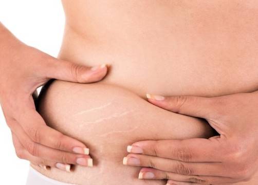 Най-добрите продукти за борба със стриите