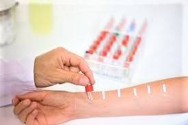 Изследване за чувствителност към алергени с кожно-алергично тестуване