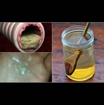 Дори лекарят ми е изумен, мисли, че съм чудо на медицината! А аз просто пия по 2 чаши от това всеки ден…