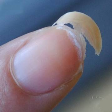 Тялото ви говори, но вие не го чувате! Ако ви се яде солено или сладко, това значи, че то се нуждае спешно от..