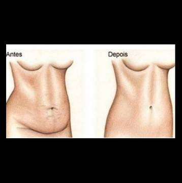 Как да накарате метаболизмът ви да работи за вас, за да може да ядете каквото си искате и да не качвате килограми