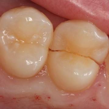 Пет животоспасяващи сигнали, които тялото ви изпраща: Научете се, как да ги разпознавате!