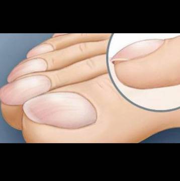 Ранни симптоми на чернодробно увреждане, които всеки игнорира