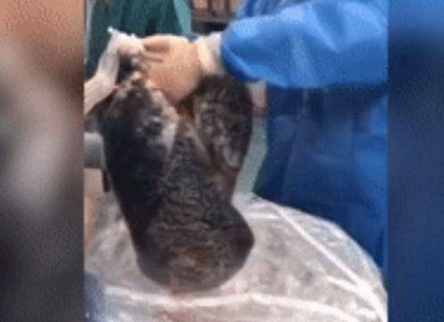 Лекари показаха как изглеждат белите дробове след 30 години пушене ВИДЕО 18