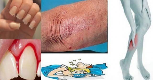 Това са случаите, в които тялото ви се моли да му помогнете, а вие ги пренебрегвате с лека ръка