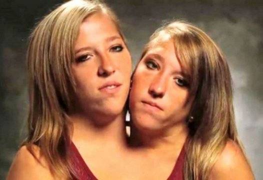 Шокиращи случаи на двуглави мутанти СНИМКИ 18 |