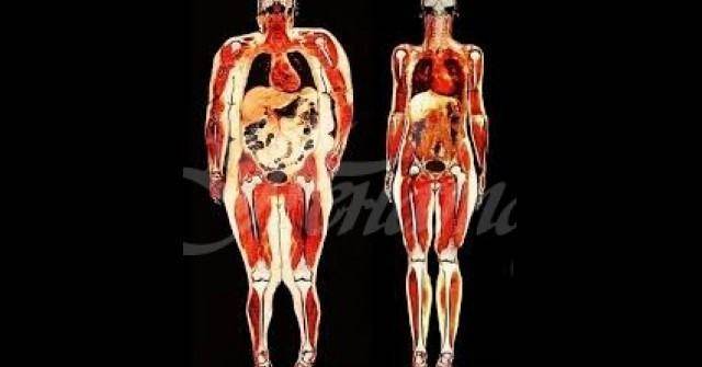 Отървете се от най-опасните мазнини по тялото си. Висцералната мазнина коварно задушава вътрешните ни органи!
