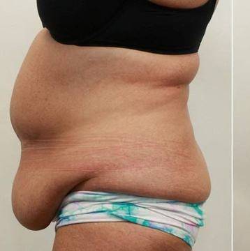 Подготвяте се за почивка, а коремът ви виси! За 7 дни ще бъде плосък като дъска, ако направите това! Влезте в „Клуба на…