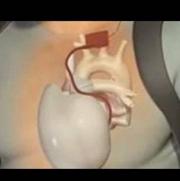 Прескача ви сърцето, или ви пробожда в гърдите? Лекарство на монахиня отпреди 800 години, ще реши всичките ви трудности