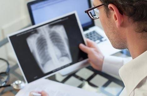 България сред първите в ЕС по брой заболели от туберкулоза