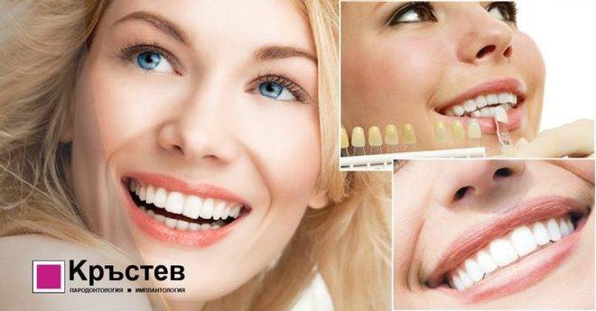 Да поговорим за избелване на зъби и блестящи усмивки!