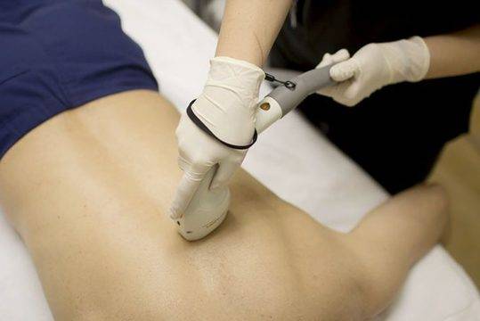 Точно какво е нужно реално знаем за премахването на косми с лазер