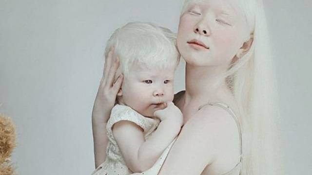 Тези деца подлудиха нета с красотата си