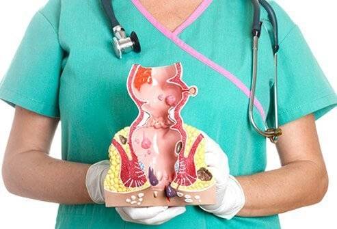 Причини за хемороиди