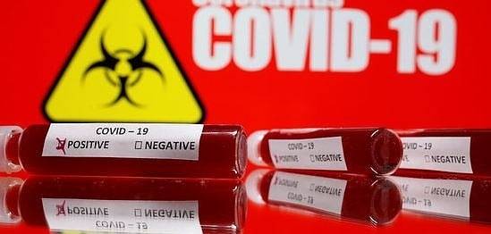 Частните лаборатории започват бързи тестове за коронавирус следващата седмица