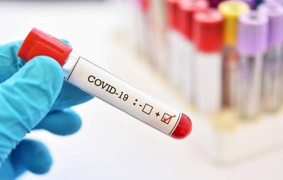 Прогнозата на БАН: Ако спазваме карантината, до 2-3 месеца ще се справим с коронавируса